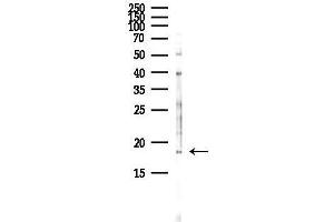Western blot analysis of lysates from HepG2 cells(heat-shock,45 min treatment), using RP Antibody at 1/1000 dilution.