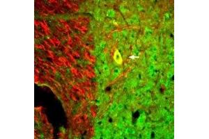 Expression of Neurotrophin 3 in mouse spinal cord - Immunohistochemical staining of perfusion-fixed frozen mouse spinal cord sections with Anti-Neurotrophin 3 (NT-3) Antibody (ABIN7043392, ABIN7044748 and ABIN7044749), (1:300), followed by goat-anti-rabbit-AlexaFluor-488 (green). (Neurotrophin 3 抗体  (Intracellular))