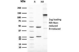 SDS-PAGE Analysis Purified Mammaglobin Recombinant Rabbit Monoclonal (MGB1/2123R). (Recombinant Mammaglobin A 抗体)