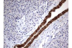 Image no. 1 for anti-Tuberous Sclerosis 1 (TSC1) (AA 836-1164) antibody (ABIN1491685) (TSC1 抗体  (AA 836-1164))