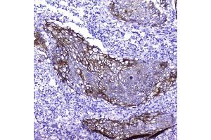 IHC analysis of Periplakin using anti-Periplakin antibody (ABIN5518787).