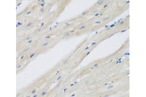 Immunohistochemistry of paraffin-embedded Mouse heart using NAA50 Polyclonal Antibody at dilution of 1:200 (40x lens).