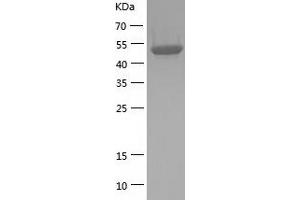 Western Blotting (WB) image for Tubulin beta 4a (TUBB4A) (AA 1-444) protein (His tag) (ABIN7125519) (TUBB4 Protein (AA 1-444) (His tag))