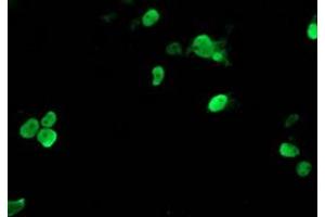 Image no. 1 for anti-T-Cell Acute Lymphocytic Leukemia 1 (TAL1) antibody (ABIN1501290) (TAL1 抗体)