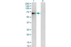 Western Blotting (WB) image for anti-ERO1-Like Protein alpha (ERO1L) (AA 90-179) antibody (ABIN599232) (ERO1L 抗体  (AA 90-179))