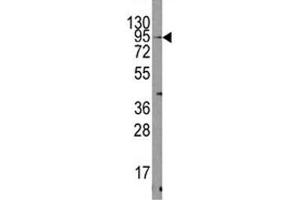 Western blot analysis of TRPV3 antibody and mouse heart tissue lysate