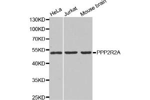 Western blot analysis of extracts of various cell lines, using PPP2R2A antibody (ABIN6291584) at 1:1000 dilution. (PPP2R2A 抗体)