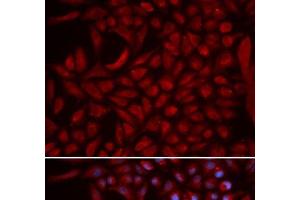 Immunofluorescence analysis of U2OS cells using CUL5 Polyclonal Antibody (Cullin 5 抗体)