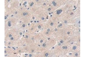 Detection of MMP19 in Human Liver Tissue using Polyclonal Antibody to Matrix Metalloproteinase 19 (MMP19)