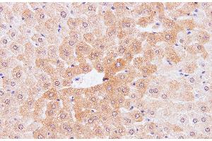 Immunohistochemistry of paraffin-embedded Mouse liver using IL2 Polyclonal Antibody at dilution of 1:100 (IL-2 抗体)