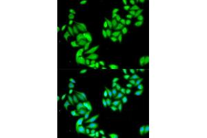 Immunofluorescence (IF) image for anti-Inhibitor of kappa Light Polypeptide Gene Enhancer in B-Cells, Kinase beta (IKBKB) (AA 630-730) antibody (ABIN3022876)