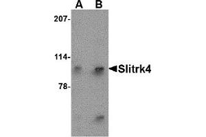 Western Blotting (WB) image for anti-SLIT and NTRK-Like Family, Member 4 (SLITRK4) (N-Term) antibody (ABIN1031578) (SLITRK4 抗体  (N-Term))