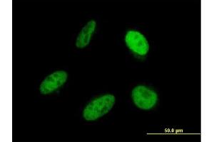Immunofluorescence of monoclonal antibody to SRP68 on HeLa cell. (SRP68 抗体  (AA 531-627))