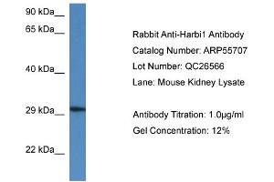 Western Blotting (WB) image for anti-Harbinger Transposase Derived 1 (HARBI1) (N-Term) antibody (ABIN2786327) (HARBI1 抗体  (N-Term))