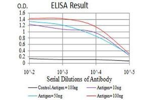 Black line: Control Antigen (100 ng),Purple line: Antigen (10 ng), Blue line: Antigen (50 ng), Red line:Antigen (100 ng) (RAB1B 抗体  (AA 60-201))