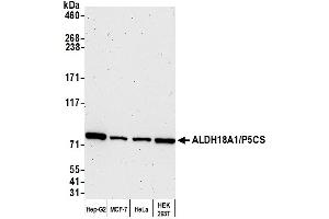 anti-Aldehyde Dehydrogenase 18 Family, Member A1 (ALDH18A1) (AA 745-795) antibody