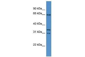 Cpne5 antibody used at 0. (Copine V 抗体  (N-Term))
