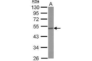 WB Image Sample (50 ug of whole cell lysate) A: Mouse brain 10% SDS PAGE antibody diluted at 1:500 (CRHR1 抗体  (N-Term))