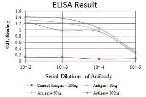 Red: Control Antigen (100 ng), Purple: Antigen (10 ng), Green: Antigen (50 ng), Blue: Antigen (100 ng), (SNAIL 抗体)