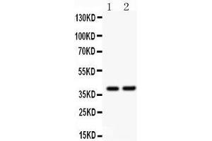 Western Blotting (WB) image for anti-SRY (Sex Determining Region Y)-Box 1 (SOX1) (AA 215-248), (Middle Region) antibody (ABIN3043439) (SOX1 抗体  (Middle Region))