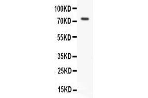 Anti- RIP antibody, Western blottingAll lanes: Anti RIP  at 0. (RIPK1 抗体  (Middle Region))