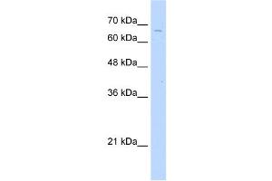 TKTL2 antibody used at 2. (TKTL2 抗体  (C-Term))
