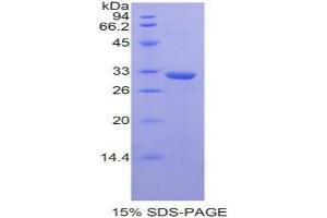 SDS-PAGE analysis of Mouse STAM Binding Protein. (STAMBP 蛋白)