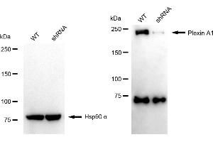 Western blotting analysis using plexin A1 antibody (ABIN7799856).