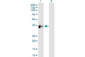 Western Blot analysis of CXorf21 expression in transfected 293T cell line by CXorf21 MaxPab polyclonal antibody. (CXorf21 抗体  (AA 1-301))