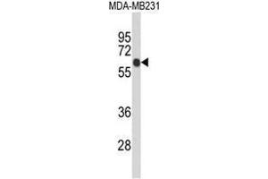 Western blot analysis of ANKRD13C Antibody (N-term) in MDA-MB231 cell line lysates (35µg/lane). (ANKRD13C 抗体  (N-Term))
