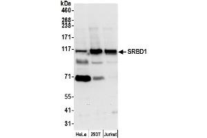 anti-S1 RNA Binding Domain 1 (SRBD1) (AA 25-75) antibody
