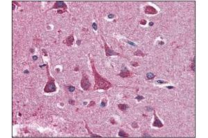 Immunohistochemistry (IHC) image for anti-14-3-3 theta (YWHAQ) (AA 1-245), (N-Term) antibody (ABIN336110) (14-3-3 theta 抗体  (N-Term))