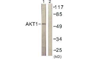 Immunohistochemistry analysis of paraffin-embedded human skeletal muscle tissue using Akt (Ab-129) antibody. (AKT1 抗体  (Ser129))