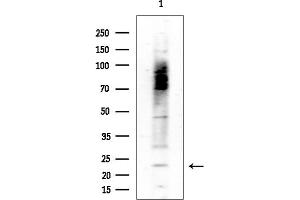 Western blot analysis of lysates from COLO205 cells(heat-shock treatment), using SF Antibody at 1/1000 dilution.