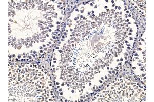 ABIN7094657 and ABIN7098708 at 1/100 staining rat testis tissue by IHC-P.