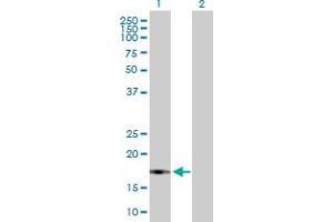 Western Blot analysis of UBL4B expression in transfected 293T cell line by UBL4B MaxPab polyclonal antibody. (UBL4B 抗体  (AA 1-174))
