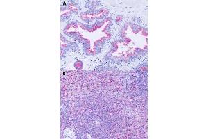 Immunohistochemical staining of formalin-fixed paraffin-embedded human prostate (A) and human spleen (B) with GPR63 polyclonal antibody . (GPR63 抗体  (Extracellular Domain))