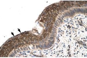 Rabbit Anti-ZFP1 Antibody Catalog Number: ARP31586 Paraffin Embedded Tissue: Human Spermatophore Cellular Data: Epithelial cells Antibody Concentration: 4. (Zfp-1 抗体  (N-Term))