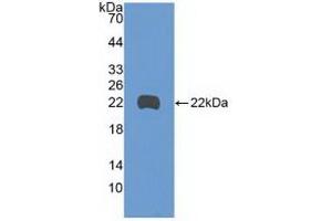 Western blot analysis of recombinant Human GADD45b. (GADD45B 抗体  (AA 1-160))