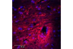 Immunofluorescence (IF) image for anti-Microtubule-Associated Protein 2 (MAP2) (AA 350-400) antibody (ABIN350476)