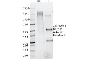 SDS-PAGE Analysis Purified CD79b Mouse Monoclonal Antibody (IGB/1844). (CD79b 抗体  (AA 29-159))