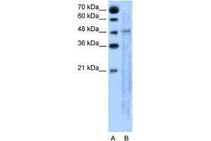 Western Blotting (WB) image for anti-Solute Carrier Family 25, Member 46 (SLC25A46) antibody (ABIN2462775) (SLC25A46 抗体)