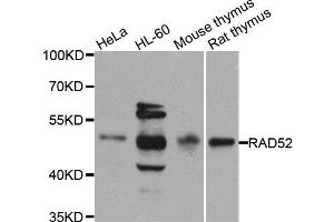 Western blot analysis of extracts of various cell lines, using RAD52 antibody. (RAD52 抗体  (AA 125-418))
