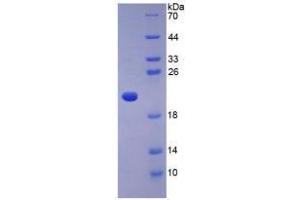 SDS-PAGE analysis of Human Adiponectin Protein. (ADIPOQ 蛋白)