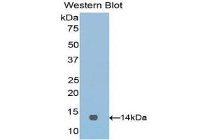 Western Blotting (WB) image for anti-V-Set Domain Containing T Cell Activation Inhibitor 1 (VTCN1) (AA 34-147) antibody (ABIN1860947) (VTCN1 抗体  (AA 34-147))