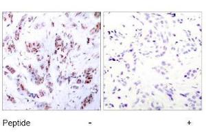 Image no. 2 for anti-Myocyte Enhancer Factor 2A (MEF2A) (Thr312) antibody (ABIN197165) (MEF2A 抗体  (Thr312))
