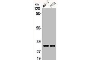 Western Blot analysis of MCF7 PC-12 cells using ACOT8 Polyclonal Antibody (ACOT8 抗体  (Internal Region))
