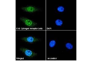 ABIN5539801 Immunofluorescence analysis of paraformaldehyde fixed HeLa cells, permeabilized with 0. (ESR2 抗体  (AA 417-428))