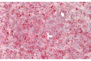 Detection of NFkB2 in Human Spleen Tissue using Polyclonal Antibody to Nuclear Factor Kappa B2 (NFkB2) (Nuclear Factor kappa B2 (AA 38-343) 抗体)