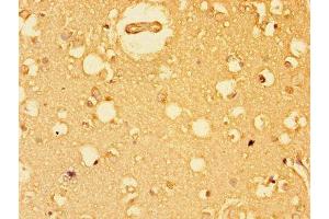 Immunohistochemistry of paraffin-embedded human brain tissue using ABIN7152184 at dilution of 1:100 (EIF4E 抗体  (AA 2-217))